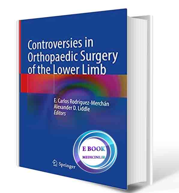 دانلود کتاب Controversies in Orthopaedic Surgery of the Lower Limb 1st ed. 2021(ORIGINAL PDF)